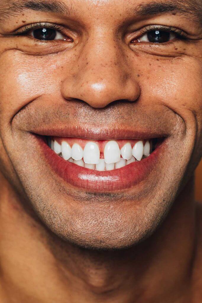 Die Besten Zahnbleaching Sets Mann lacht Eingangsfoto 30