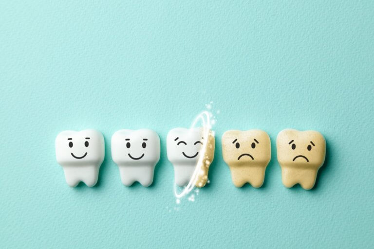 7 Gründe, warum dich weiße Zähne glücklich machen