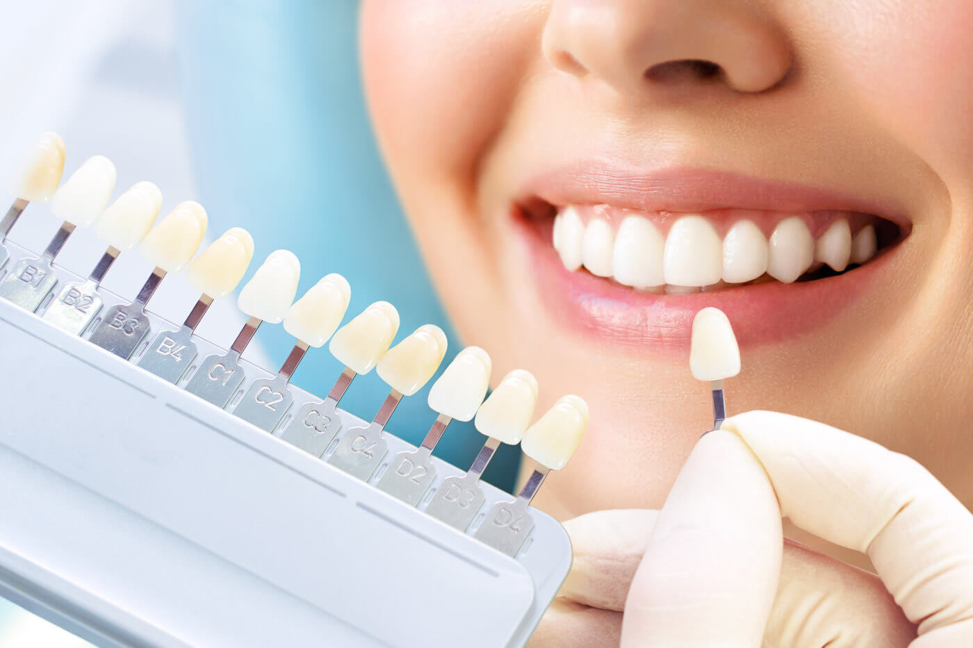 Wirkung von zahnaufhellenden Zahnpasten im Vergleich zu ähnlichen Produkten