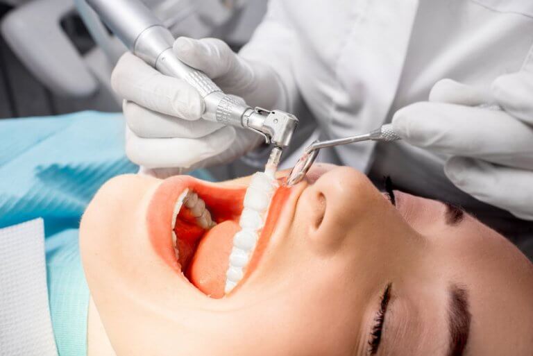Professionelle Zahnreinigung – alles, was Du wissen musst