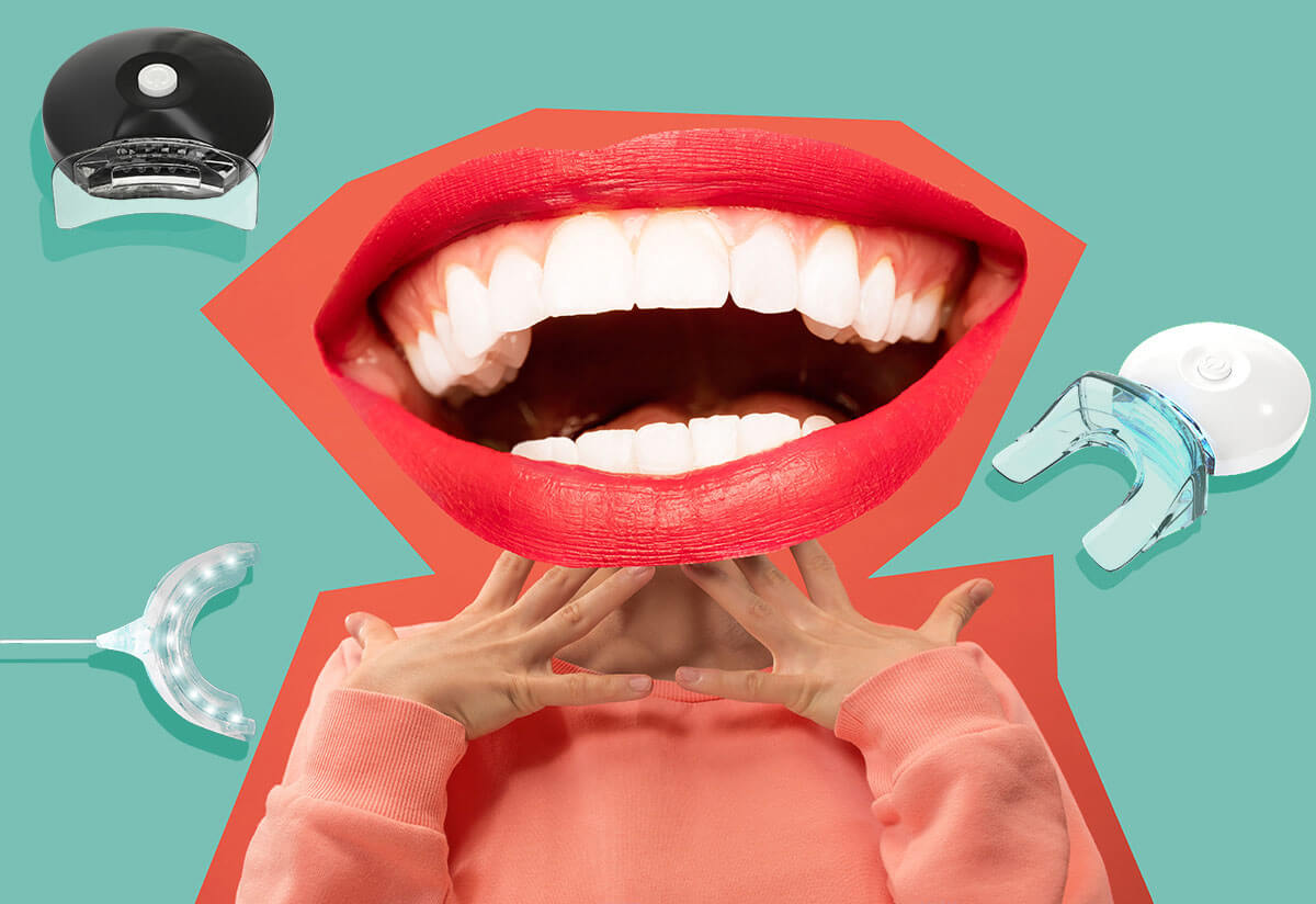 5 Meilleurs Et Plus Sûrs Kits De Blanchiment Dentaire Testés